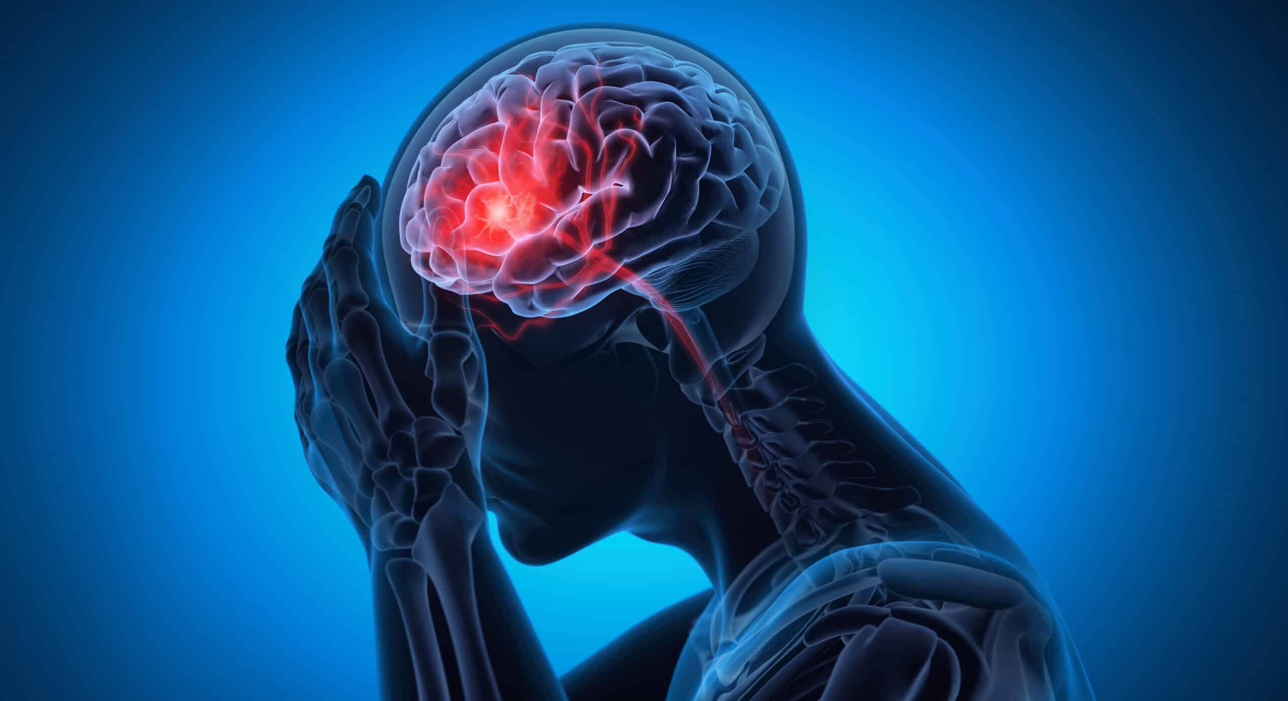 traumatic brain injury